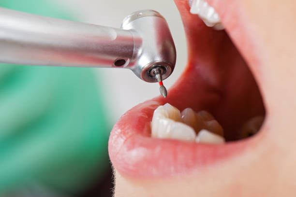 Best Urgent Tooth Repair  in Randolph, NE